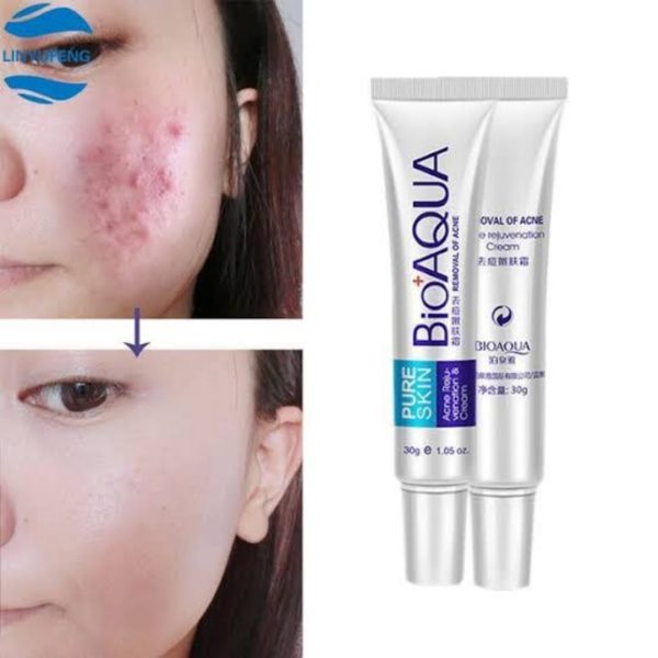 Bioaqua Anti Acne Cream Acne Scar Removal Cream | Best Quality Scar Removal Cream 30g( Original )